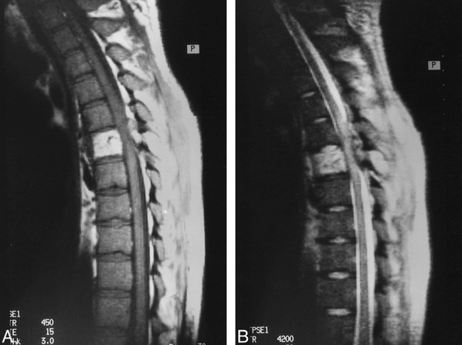 fig 3.