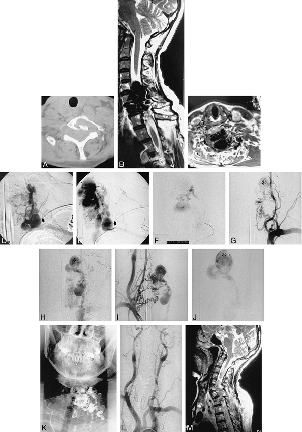 fig 1.