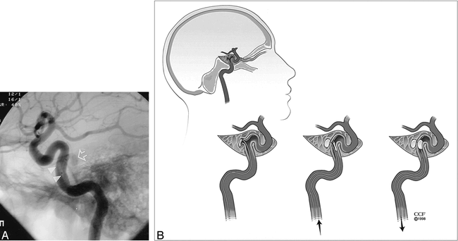 fig 3.