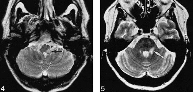fig 4.