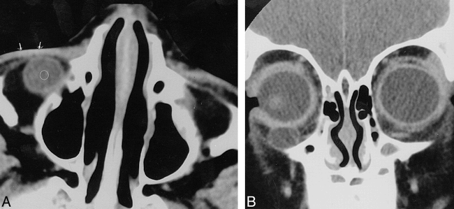fig 1.