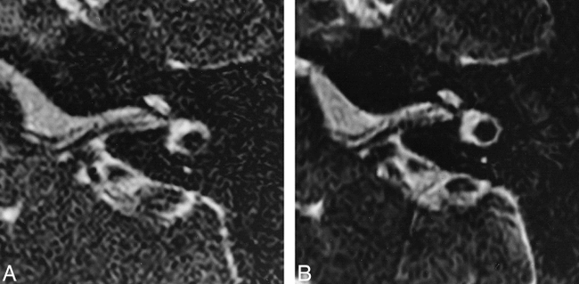 fig 5.