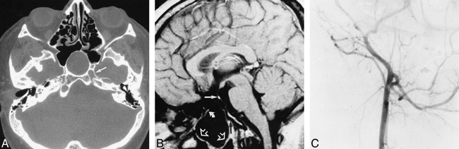 fig 1.
