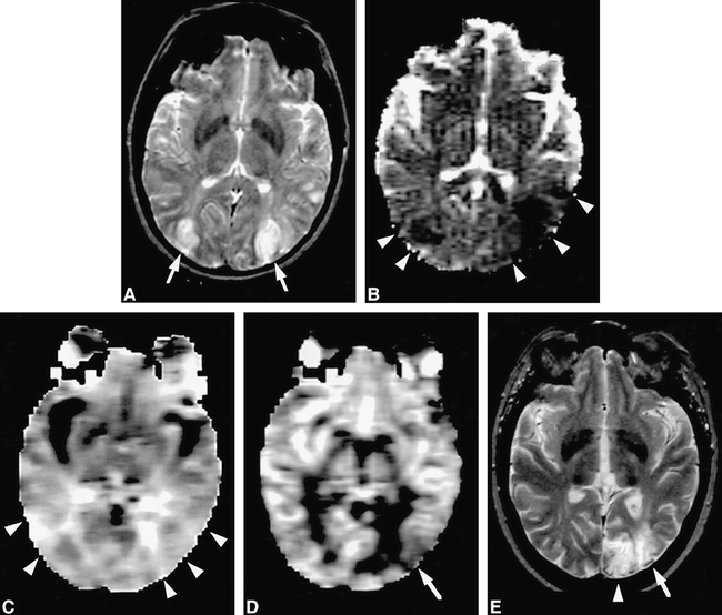 fig 2.