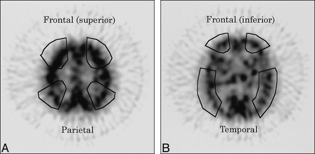 fig 4.