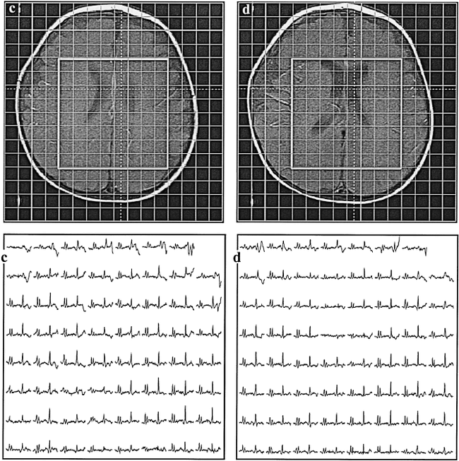 fig 6.