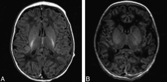 fig 1.