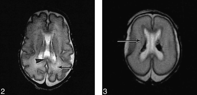 fig 2.