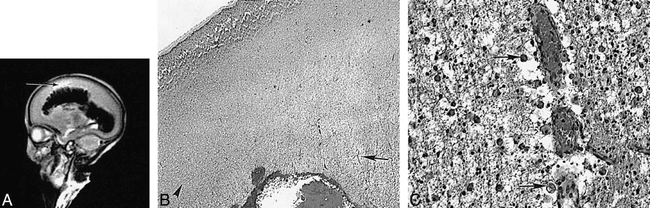 fig 4.