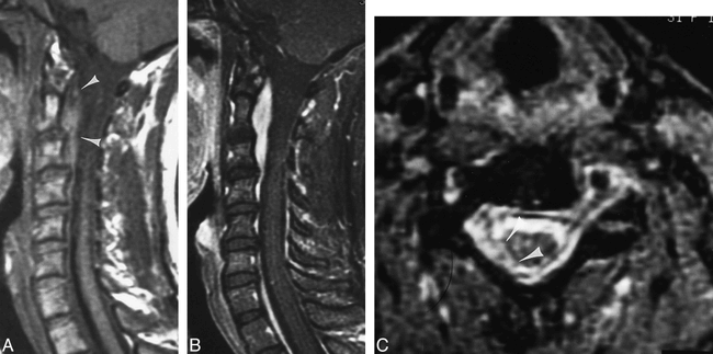 fig 3.