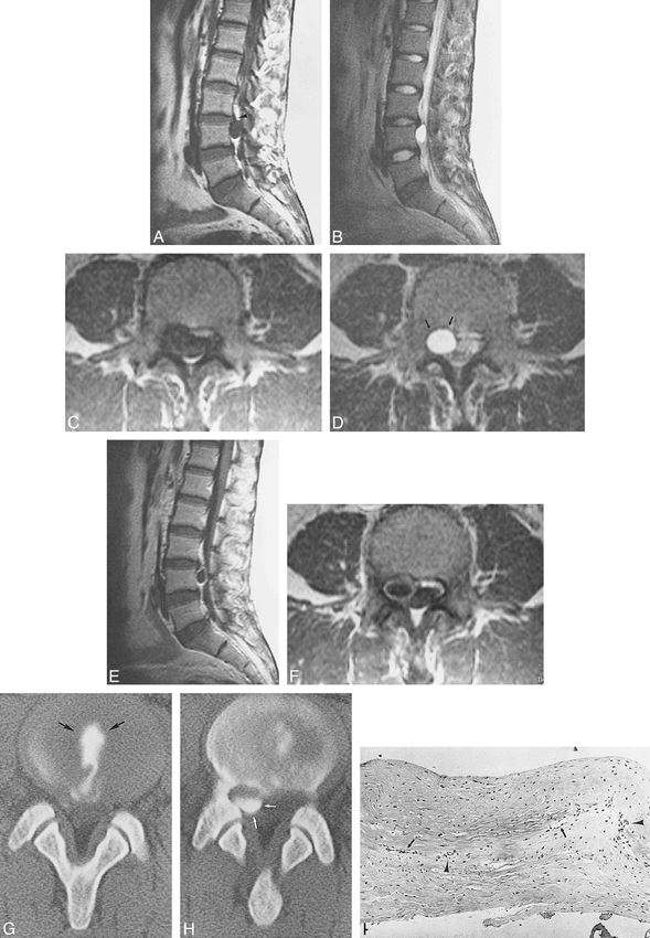 fig 1.