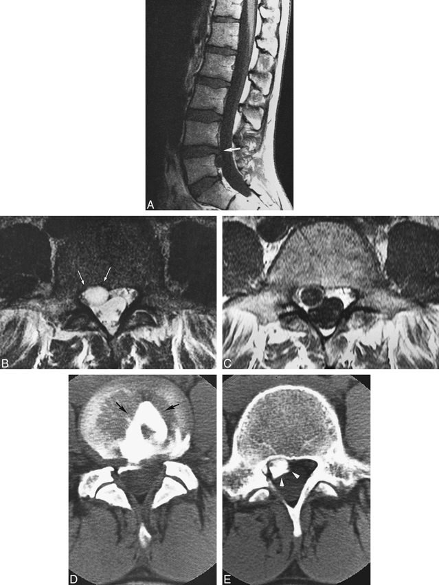 fig 2.