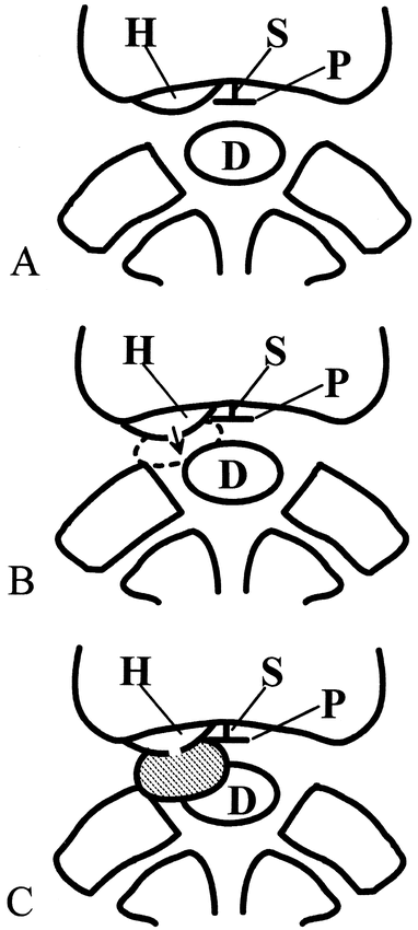 fig 3.