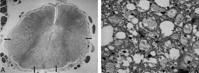 fig 4.