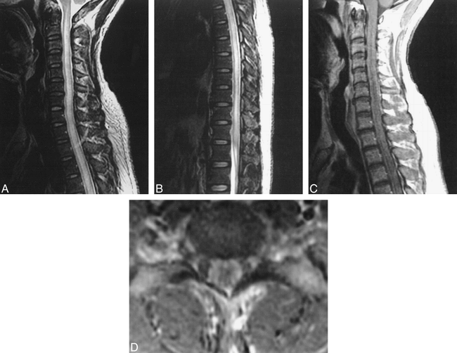 fig 1.