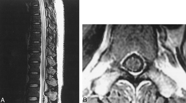 fig 3.