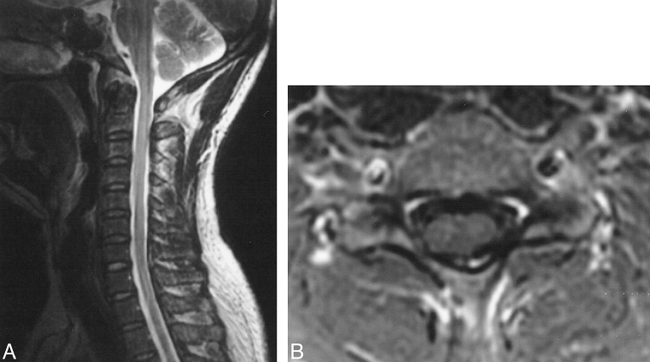 fig 4.