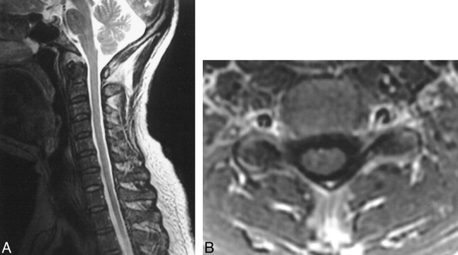 fig 5.