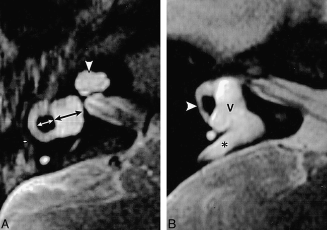 fig 6.