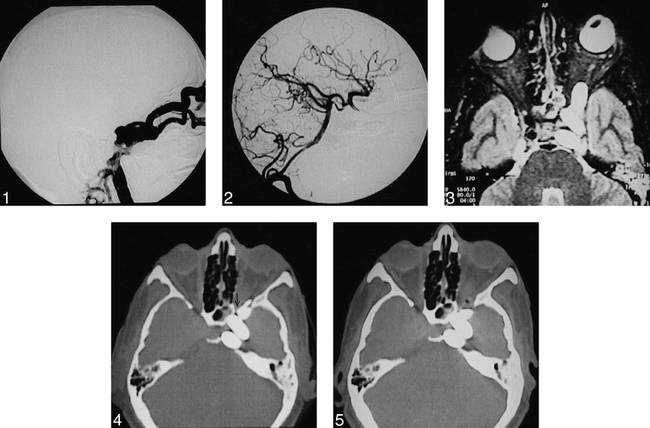 fig 1.