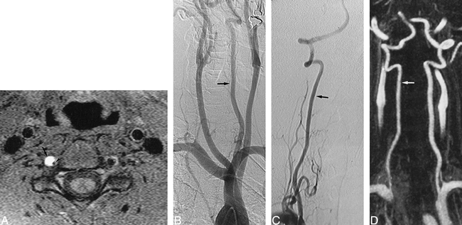 fig 2.