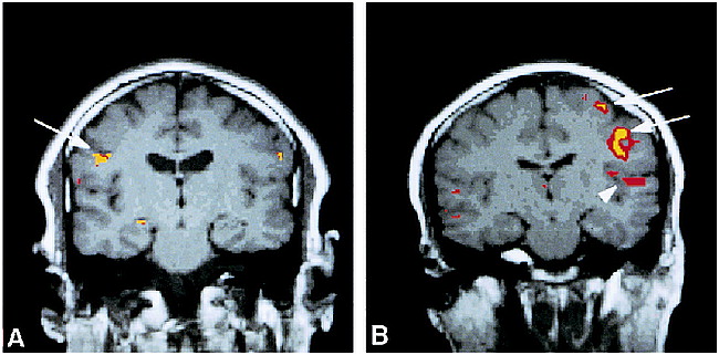 fig 1.