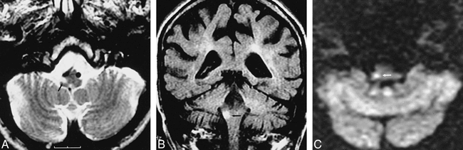 fig 6.