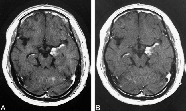 fig 3.