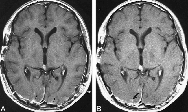 fig 4.