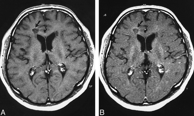 fig 5.