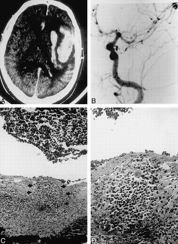 fig 1.