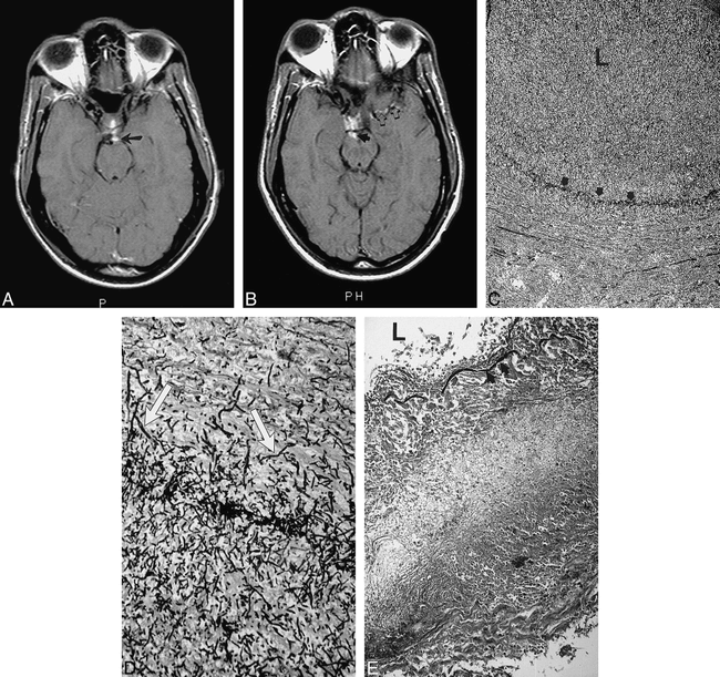 fig 2.
