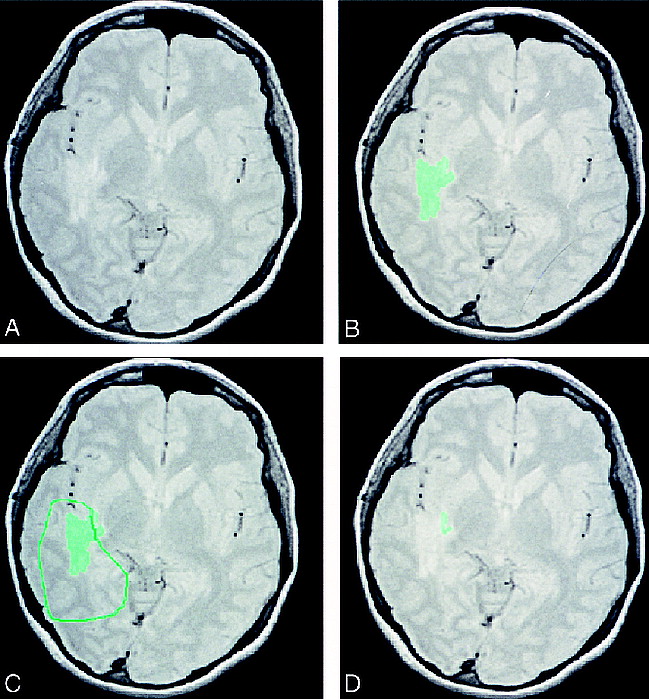 fig 1.