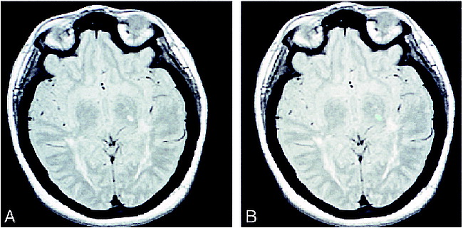 fig 2.