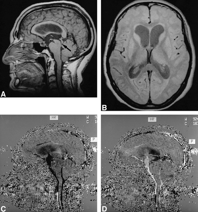 fig 3.