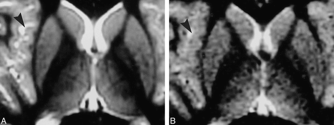 fig 2.