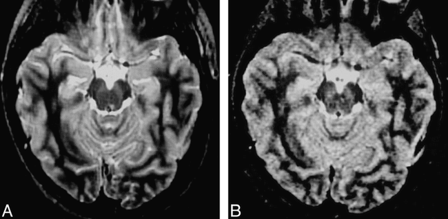 fig 3.