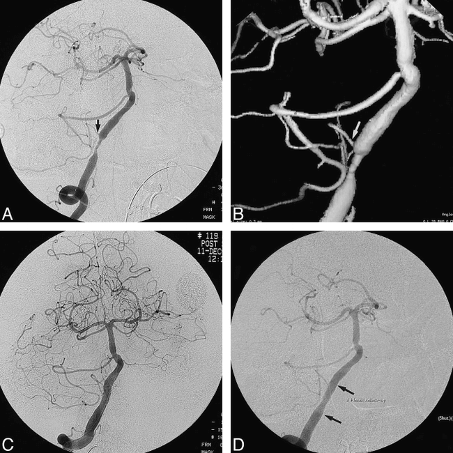 fig 2.