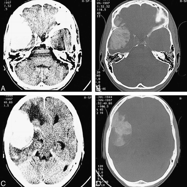 fig 3.