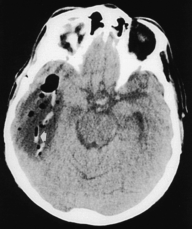 fig 2.