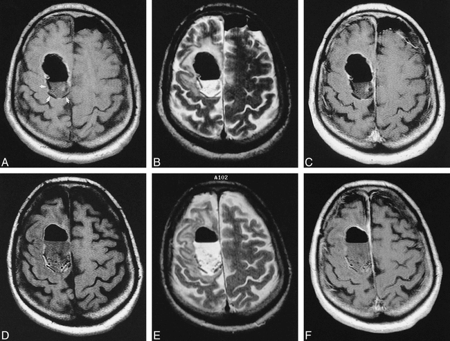 fig 4.