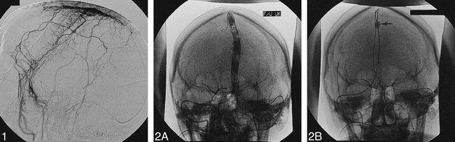 fig 1.