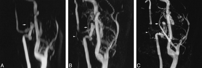 fig 3.
