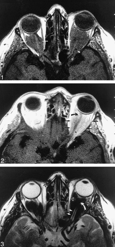 fig 1.