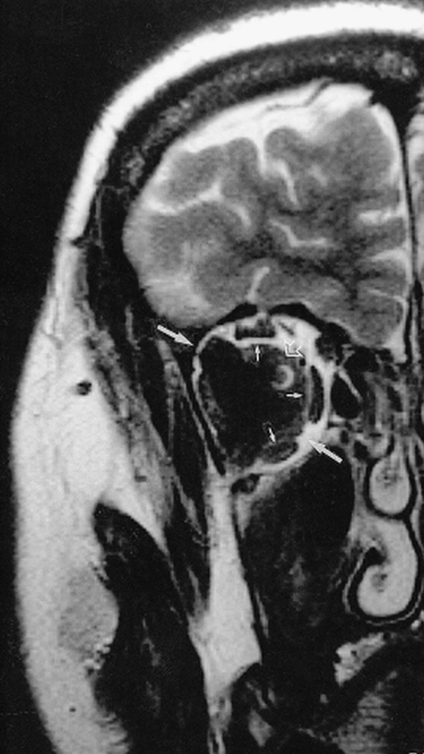 fig 4.