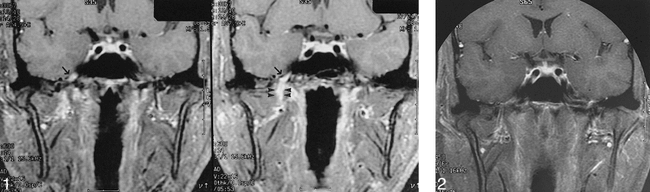 fig 1.