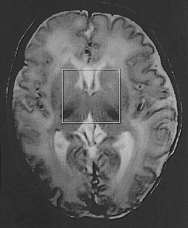 fig 1.