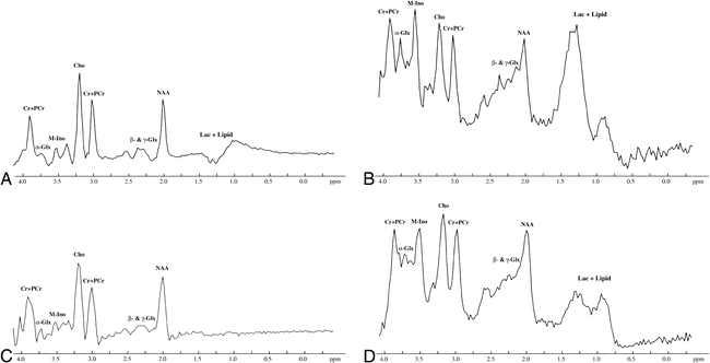 fig 3.