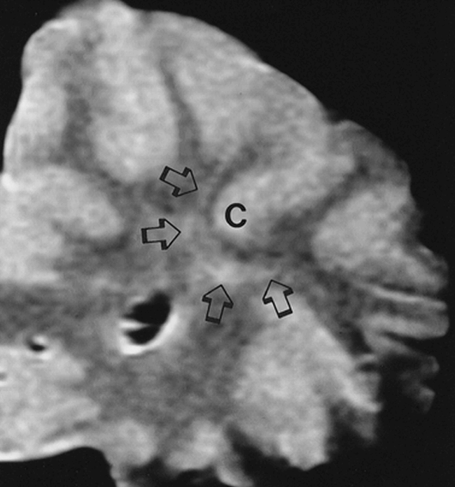 fig 1.
