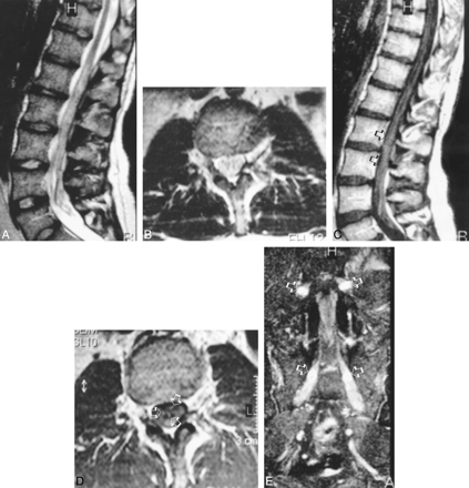 fig 1.